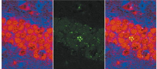 Иллюстрация к книге — Революция в голове. Как новые нервные клетки омолаживают мозг [i_031.jpg]