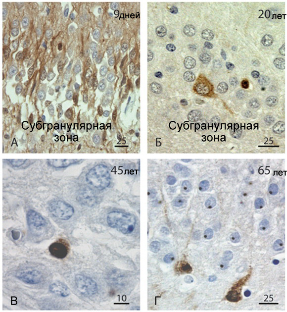 Иллюстрация к книге — Революция в голове. Как новые нервные клетки омолаживают мозг [i_033.jpg]